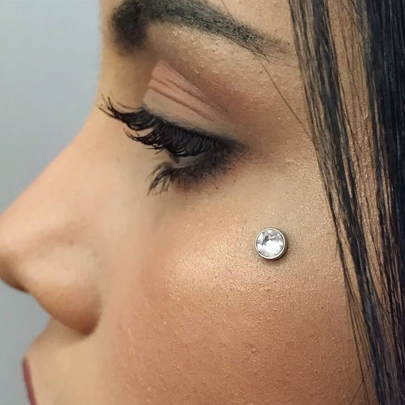 microdermal_example_image